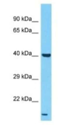 LPAR6/P2RY5 Rabbit anti-Human, Polyclonal, Novus Biologicals:Antibodies:Primary